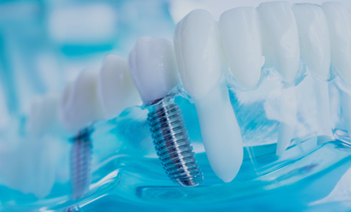 Implantology