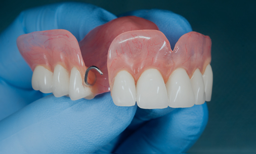 Restorative dentistry